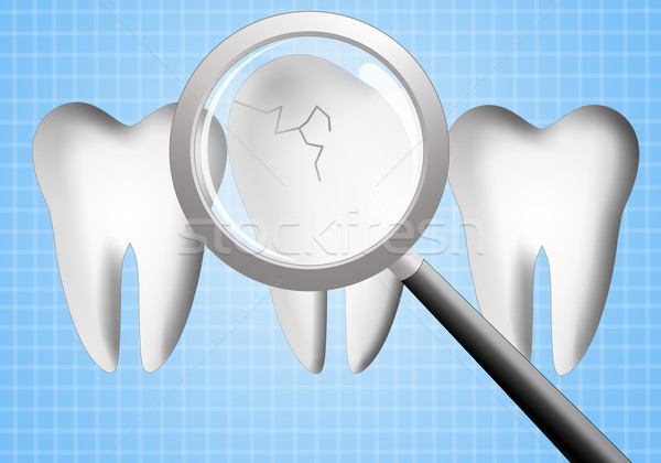 Dents soins dentaires illustration sourire médecin médecine [[stock_photo]] © sognolucido