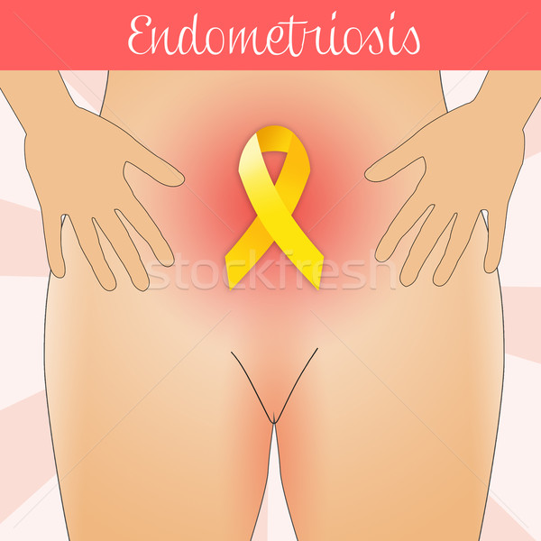Endometriosis in woman Stock photo © sognolucido