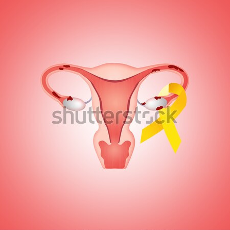 Foto stock: útero · médico · mujeres · lucha · dolor · rosa