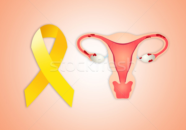 Jaune ruban illustration médecin femmes lutte [[stock_photo]] © sognolucido