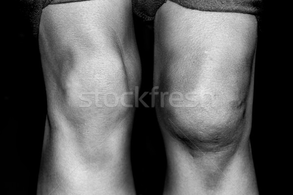 Rozdarty kolano czarno białe ranny Zdjęcia stock © soupstock