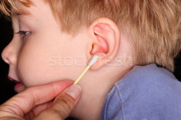 Sporca orecchio orecchie fuori cotone Foto d'archivio © soupstock