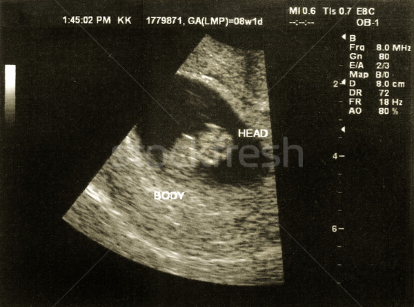 Ultrasound of a fetus at 8 weeks 1 day Stock photo © soupstock