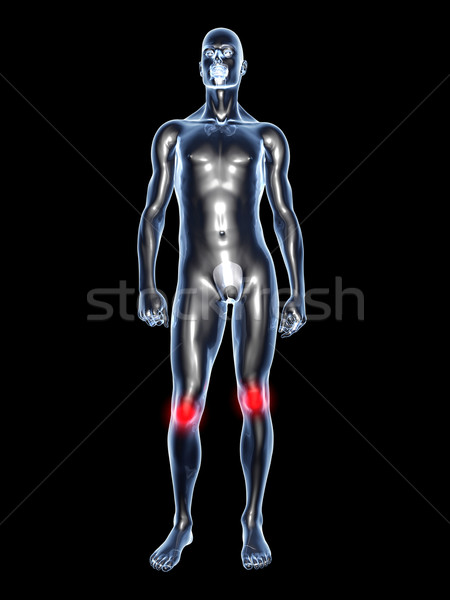 Knee Ache - Anatomy  Stock photo © Spectral