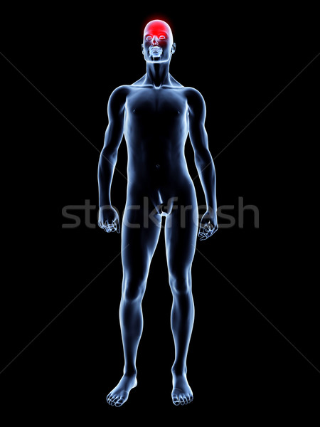 Stockfoto: Hoofdpijn · anatomie · medische · illustratie · 3D · gerenderd