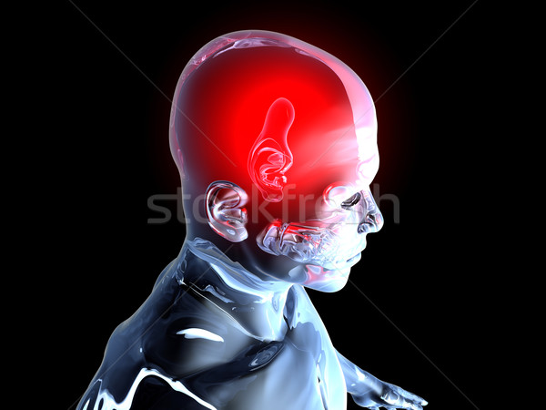 Headache - Anatomy  Stock photo © Spectral