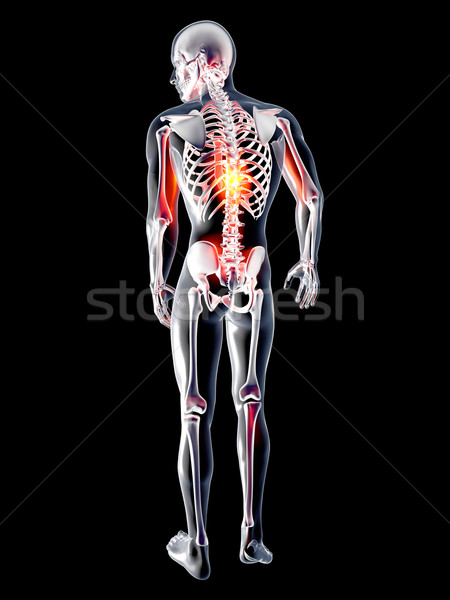 Anatomy - Back Pain	 Stock photo © Spectral