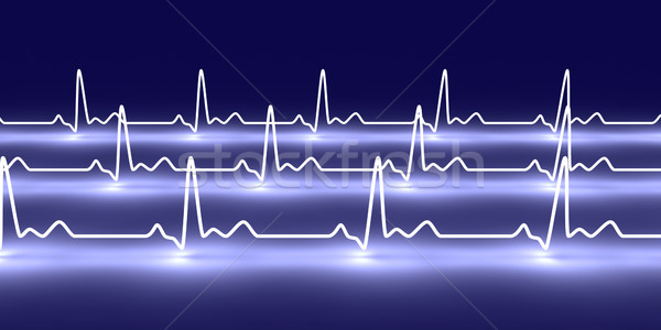 Pulse trace
 Stock photo © Spectral