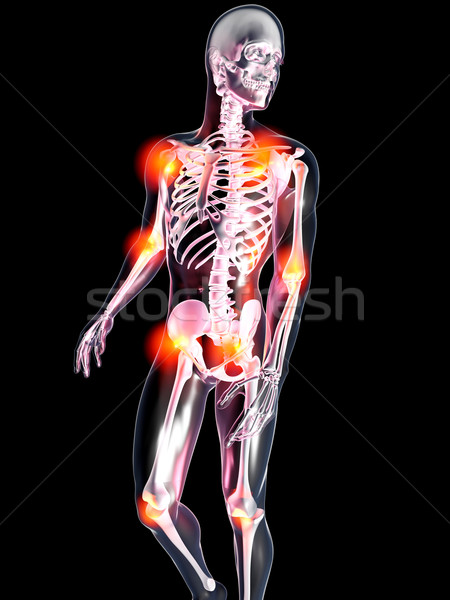 Anatomie schmerzhaft Gelenke 3D gerendert Illustration Stock foto © Spectral