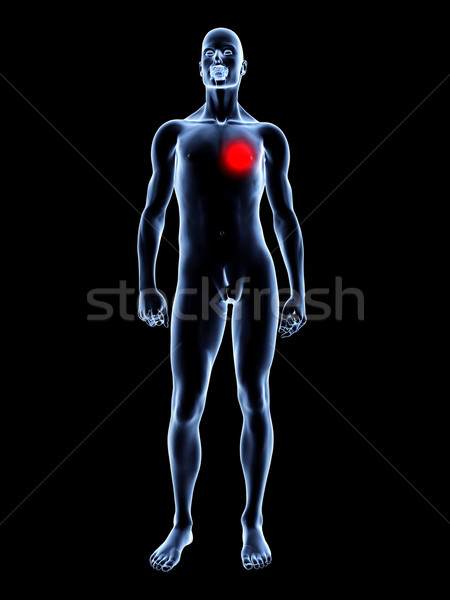 Heart Ache - Anatomy  Stock photo © Spectral