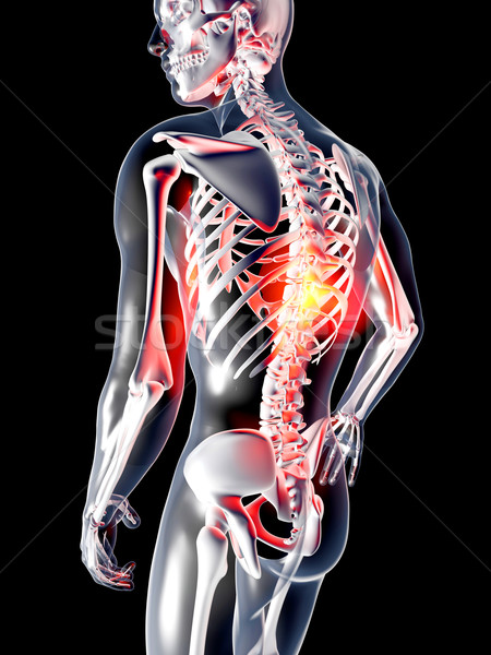Anatomie rugpijn pijn Maakt een reservekopie 3D gerenderd Stockfoto © Spectral