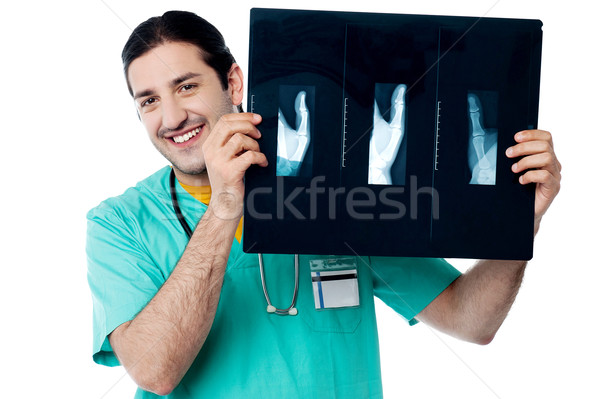 Alegre médico polegar raio x jovem Foto stock © stockyimages