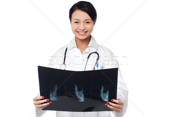 Female doctor analyzing patient's x-ray  Stock photo © stockyimages
