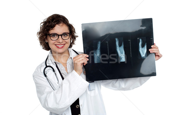 Female surgeon holding up x-ray sheet Stock photo © stockyimages