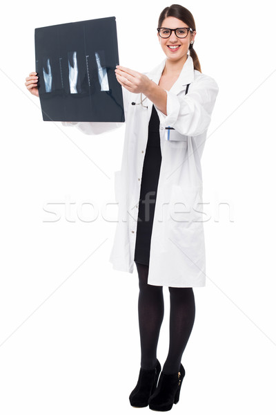 Femeie medic Xray raportează tineri ortopedic Imagine de stoc © stockyimages