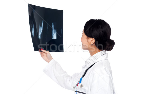 женщины врач глядя Xray докладе врач Сток-фото © stockyimages