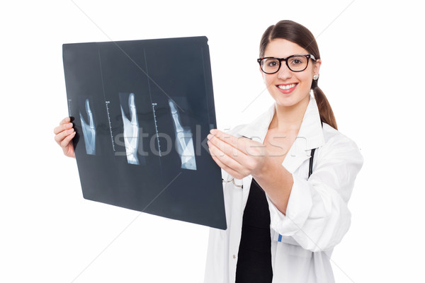 Femeie medic Xray foaie tineri Imagine de stoc © stockyimages