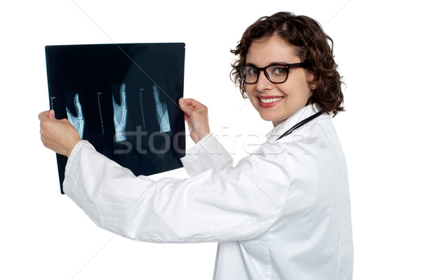 Female doctor reviewing x-ray sheet of a patient Stock photo © stockyimages