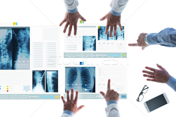 Medical team examining patient's medical records on slides Stock photo © stokkete