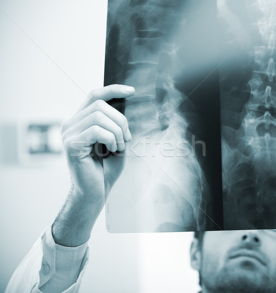 Radiologista exame profissional raio x imagem Foto stock © stokkete