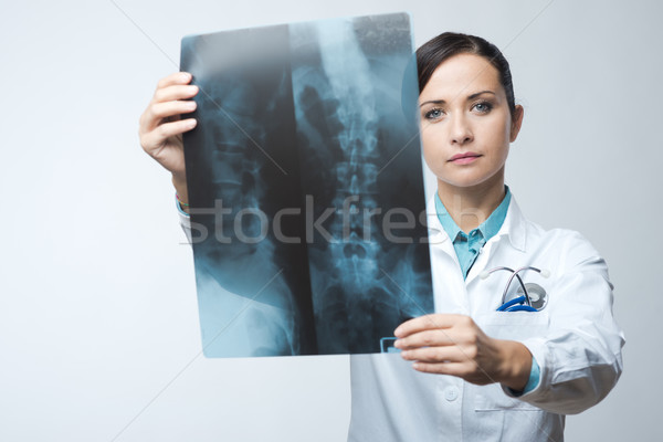 Vrouwelijke radioloog Xray afbeelding wervelkolom ziekenhuis Stockfoto © stokkete