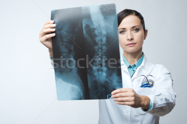 Homme radiologue xray image colonne vertébrale hôpital Photo stock © stokkete