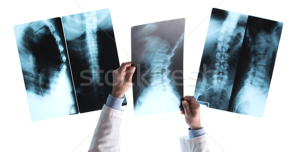 Radiologue xray image vue lumière boîte Photo stock © stokkete