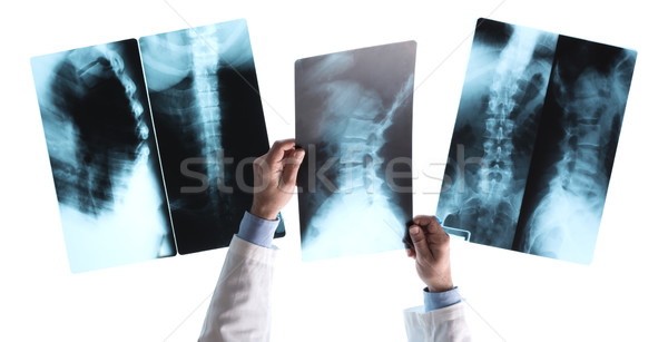 Stock photo: Radiologist checking an x-ray image