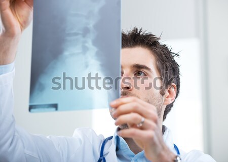 Kobiet radiolog xray obraz kręgosłup szpitala Zdjęcia stock © stokkete