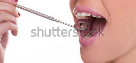 Woman with a dental mirror displaying her teeth Stock photo © stryjek
