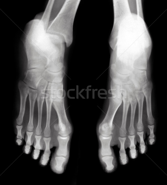 Feet Stock photo © Suljo