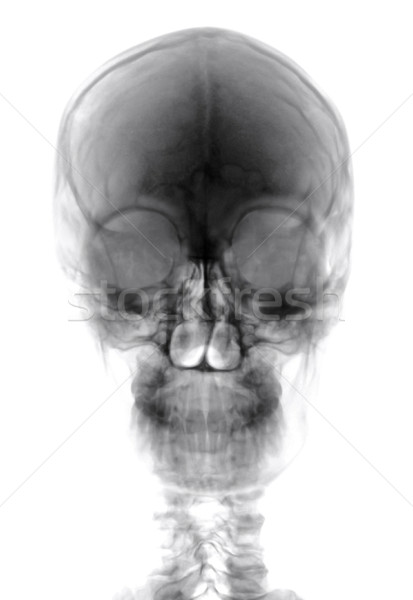 Human Head Xray Cutout Stock photo © Suljo