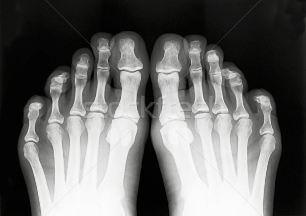 Foot fingers Stock photo © Suljo