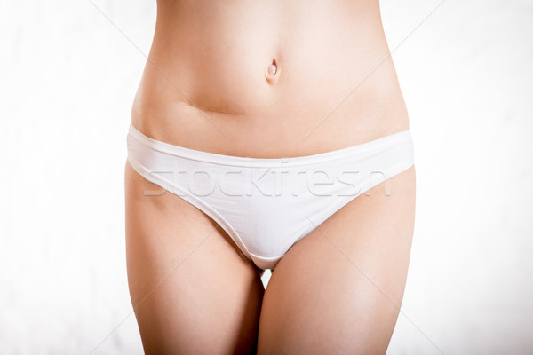 scar on the belly of a beautiful woman Stock photo © superelaks