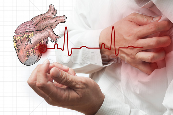 Herzinfarkt Herz EKG Gesundheit Geschäftsmann Männer Stock foto © Suriyaphoto