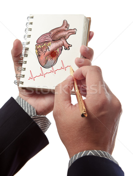 Doctor drawing heart Attack and heart beats cardiogram  Stock photo © Suriyaphoto
