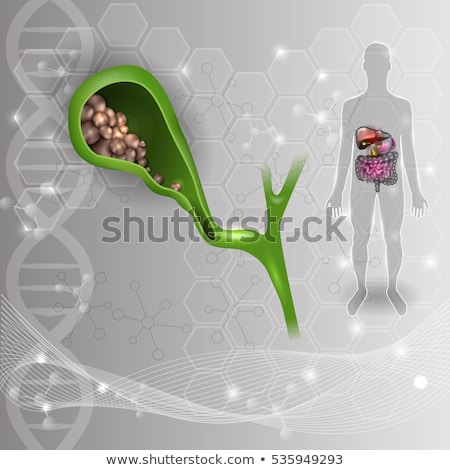 Stockfoto: Gallstones In The Gallbladder Anatomy Bright Detailed Illustrat