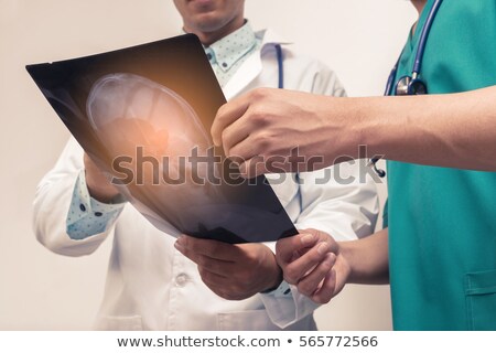 Foto stock: Doctor Examining X Ray Of The Skull