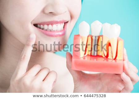 Foto stock: Dental Implant