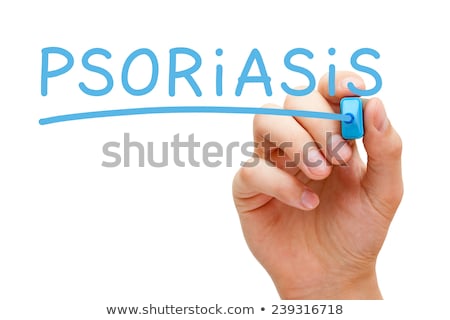 Foto stock: Psoriasis Blue Marker