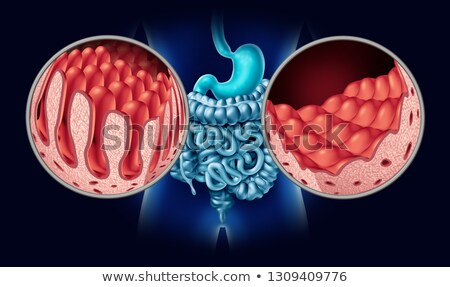 Сток-фото: Celiac Disease Medicine 3d Illustration