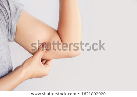 [[stock_photo]]: Woman Holding Arm With Excess Fat