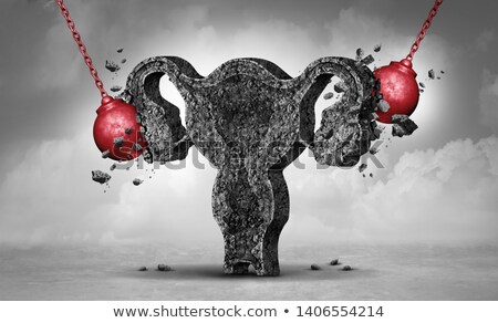 Foto stock: Female Reproductive Rights Stress