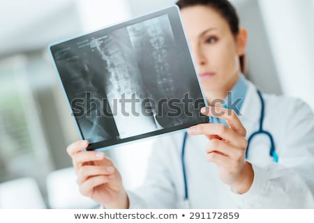 Stock fotó: Female Radiologist Checking X Ray Image