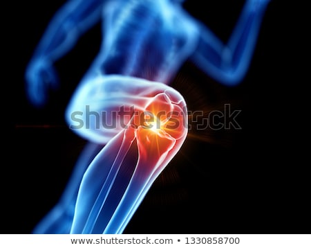 Stockfoto: 3d Rendered Illustration Of A Painful Knee