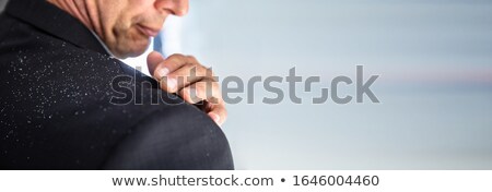 Foto d'archivio: Businessman Cleaning Dandruff Off The Shoulder