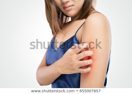 ストックフォト: People Scratch The Itch With Hand Upper Arm Itching Healthcar
