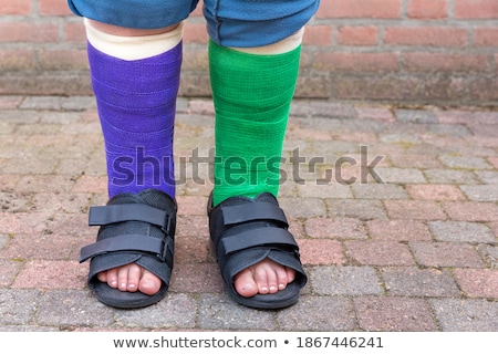 Foto stock: Standing Boy With Two Colored Gypsum Legs