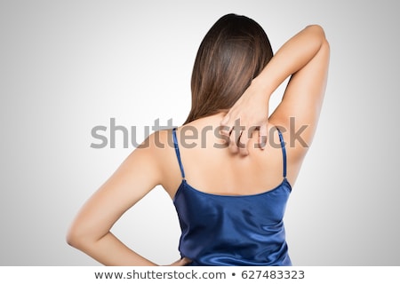 Stock photo: Woman Scratching The Itch On Her Arm