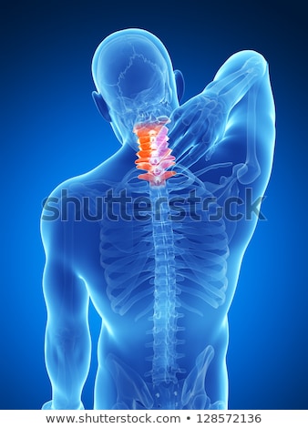 Foto stock: 3d Rendered Illustration - Painful Neck